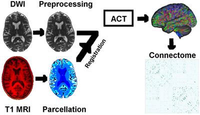 Data-Driven Sequence of Changes to Anatomical Brain Connectivity in Sporadic Alzheimer’s Disease